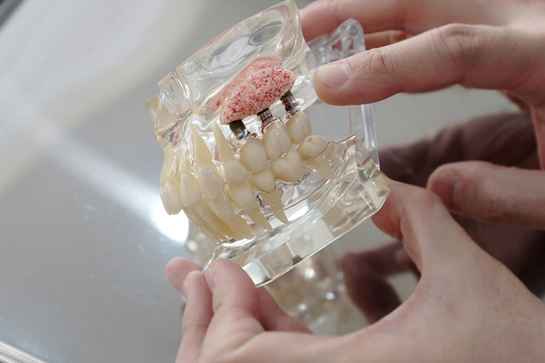 Bone graft procedure illustration